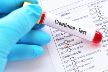 Creatinine-Test