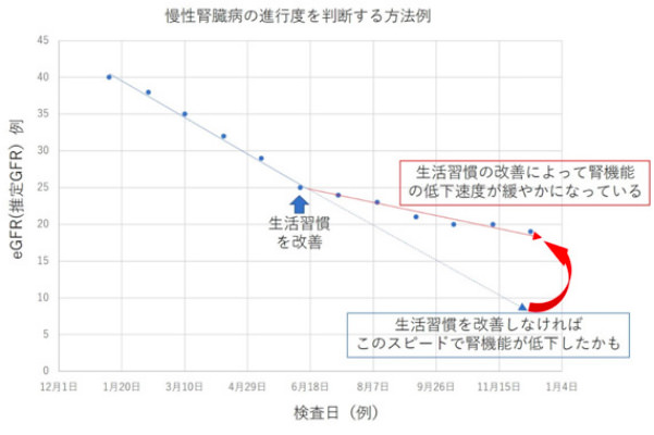 慢性腎臓病の進行度を判断する方法例