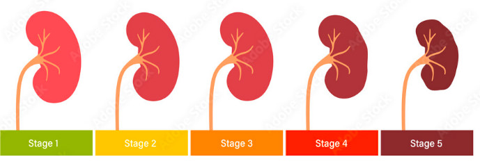 eGFR Stage